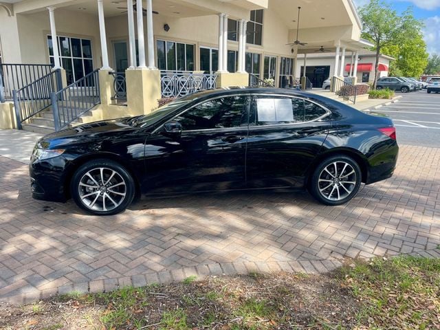 2016 ACURA TLX V6 ADVANCE - 23050028 - 1