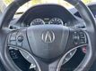 2017 Acura MDX 3.0L - 22582490 - 25