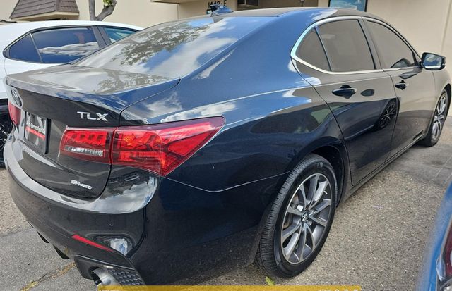 2017 Acura TLX SH-AWD V6 w/Advance Pkg - 22600096 - 1