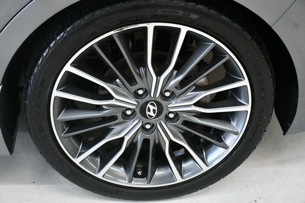 2017 Hyundai Elantra Sport photo 16