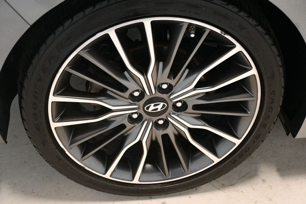 2017 Hyundai Elantra Sport photo 18