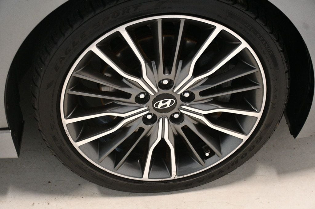 2017 Hyundai Elantra Sport photo 19