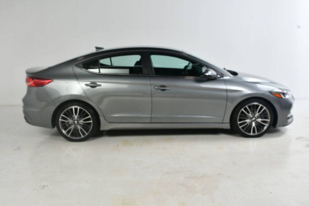 2017 Hyundai Elantra Sport photo 3