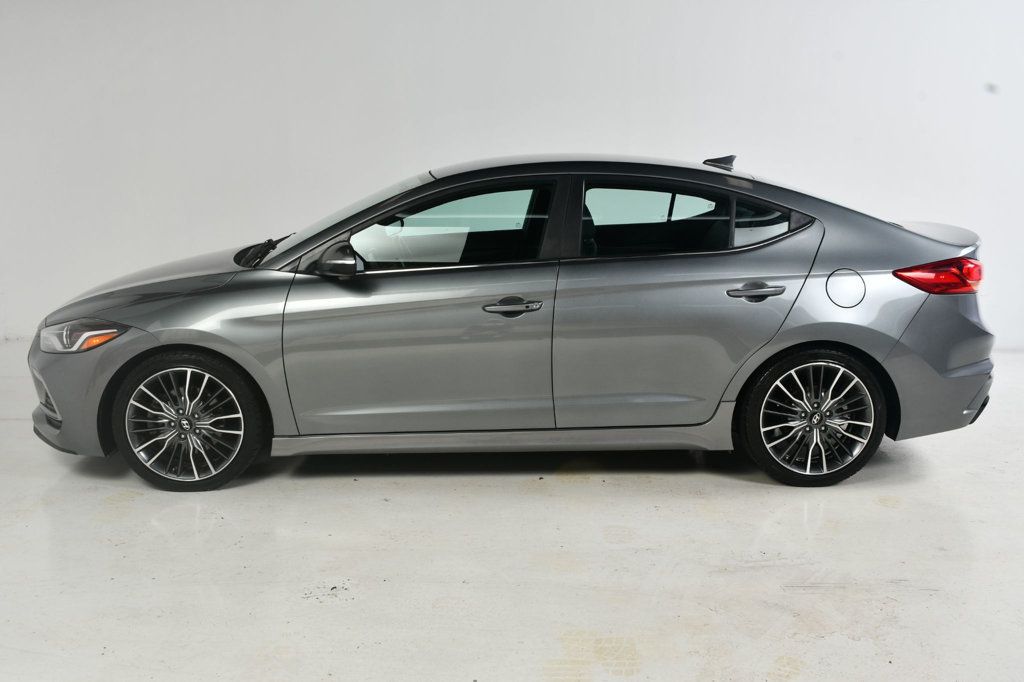 2017 Hyundai Elantra Sport photo 4