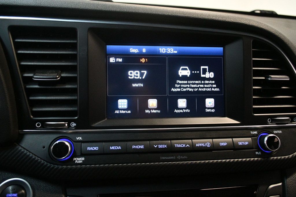 2017 Hyundai Elantra Sport photo 50