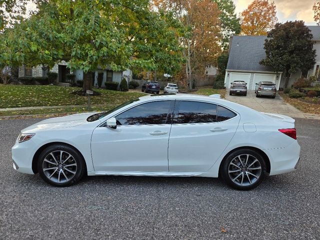 2018 Acura TLX 3.5L SH-AWD w/Technology Pkg - 22943892 - 1