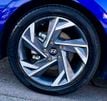 2025 Hyundai Elantra SEL Convenience IVT - 23072252 - 22